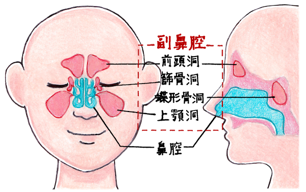 副鼻腔炎（蓄膿症）で頭痛が起こる原因