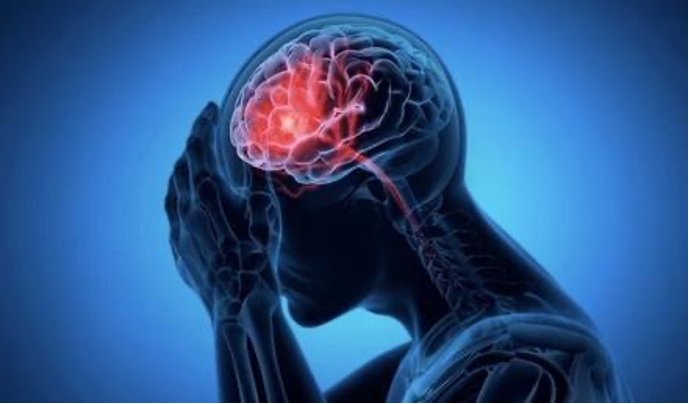 脳卒中とは？　～脳梗塞・脳出血・くも膜下出血の違いと原因～